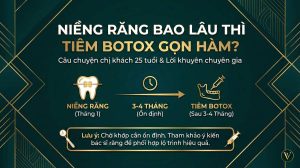 Niềng Răng Sau Bao Lâu Thì Tiêm Botox Gọn Hàm An Toàn?